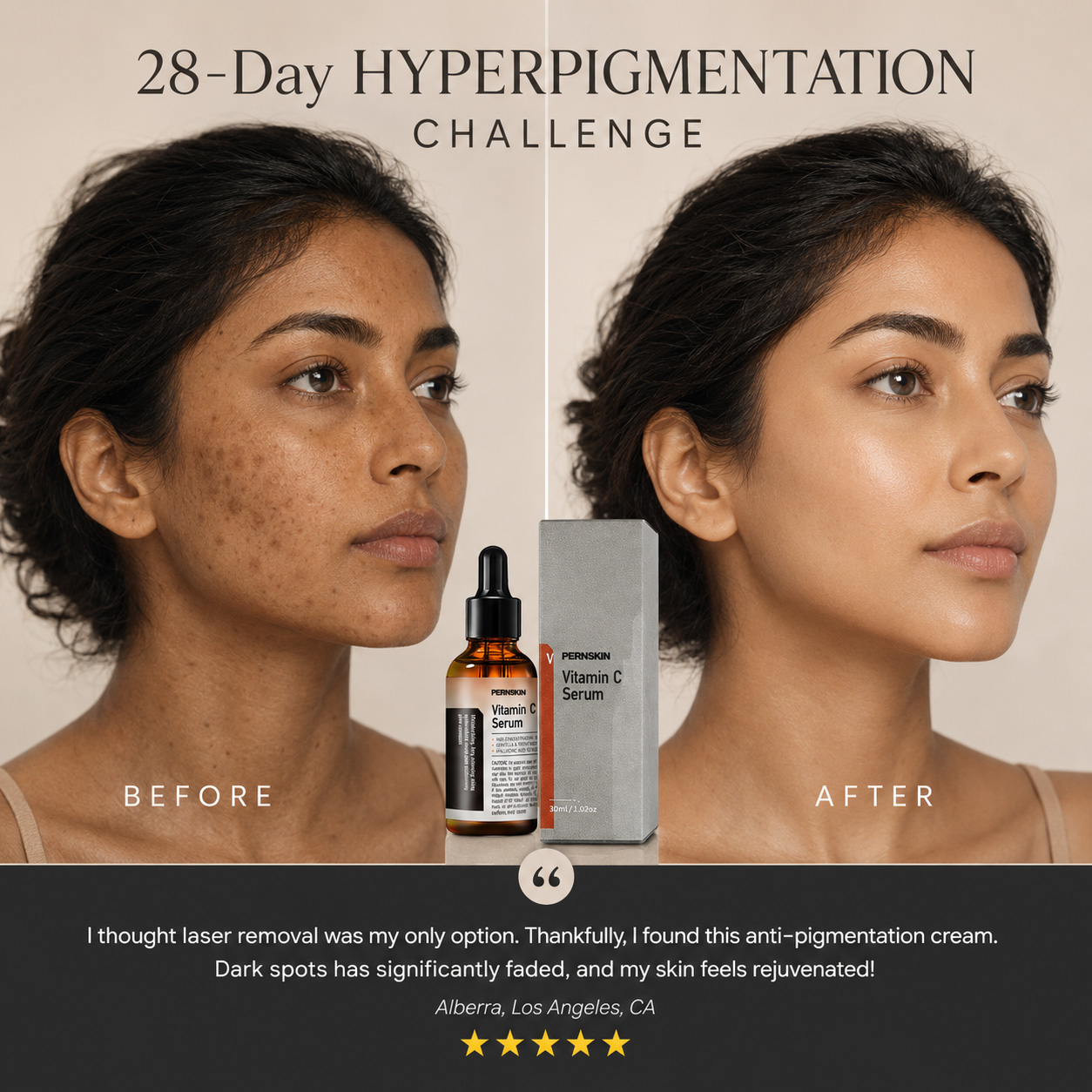vitamin c spot removing serum: comprehensive skin improvement – natural anti aging solution