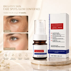 home vitamin c whitening freckles face cream remove melasma dark spots lighten melanin